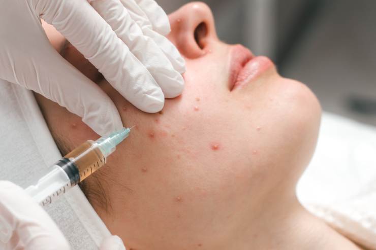 Dermatology Image