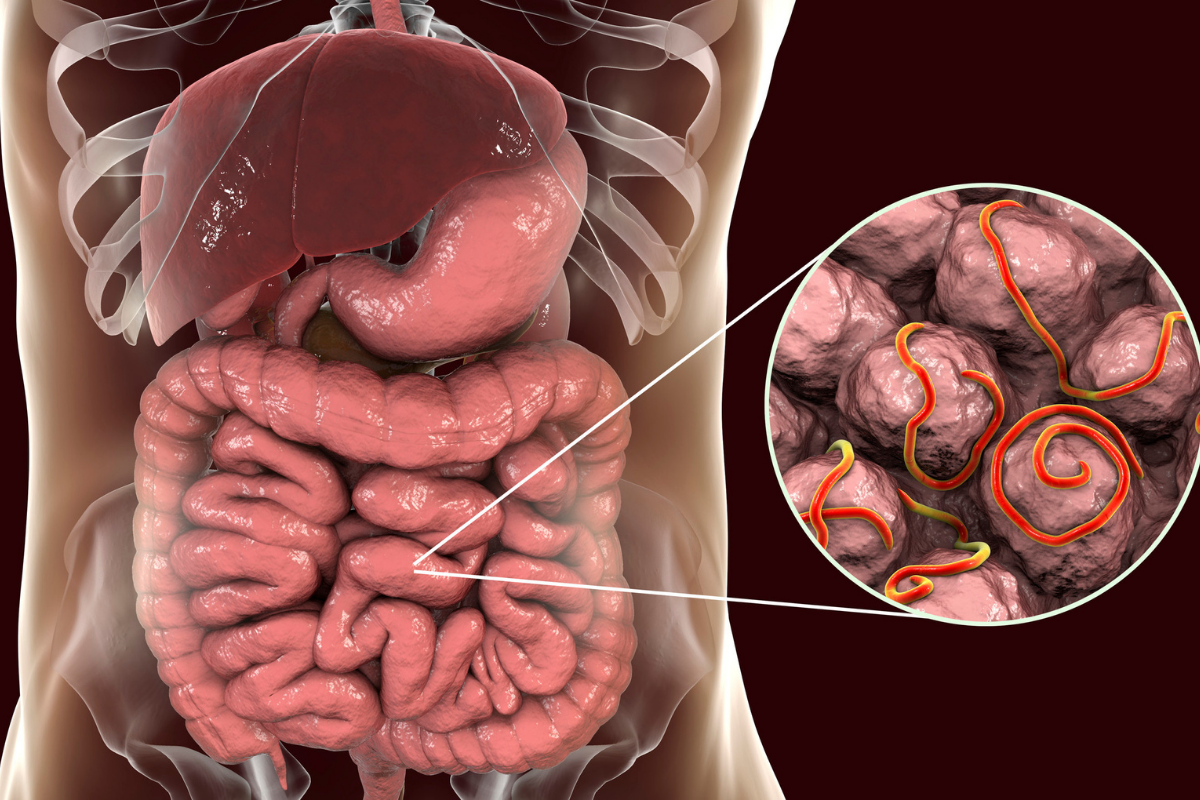 Gastroenterology Image