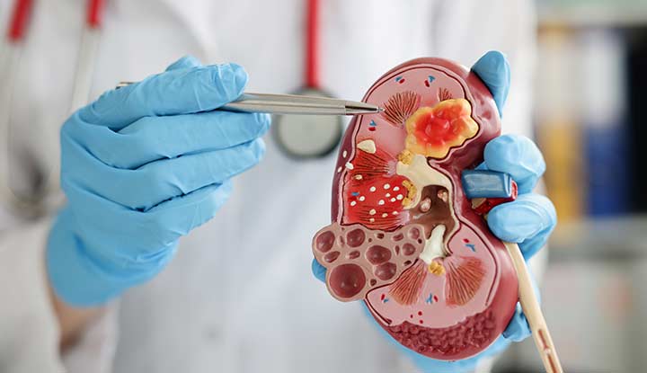 Nephrology Image